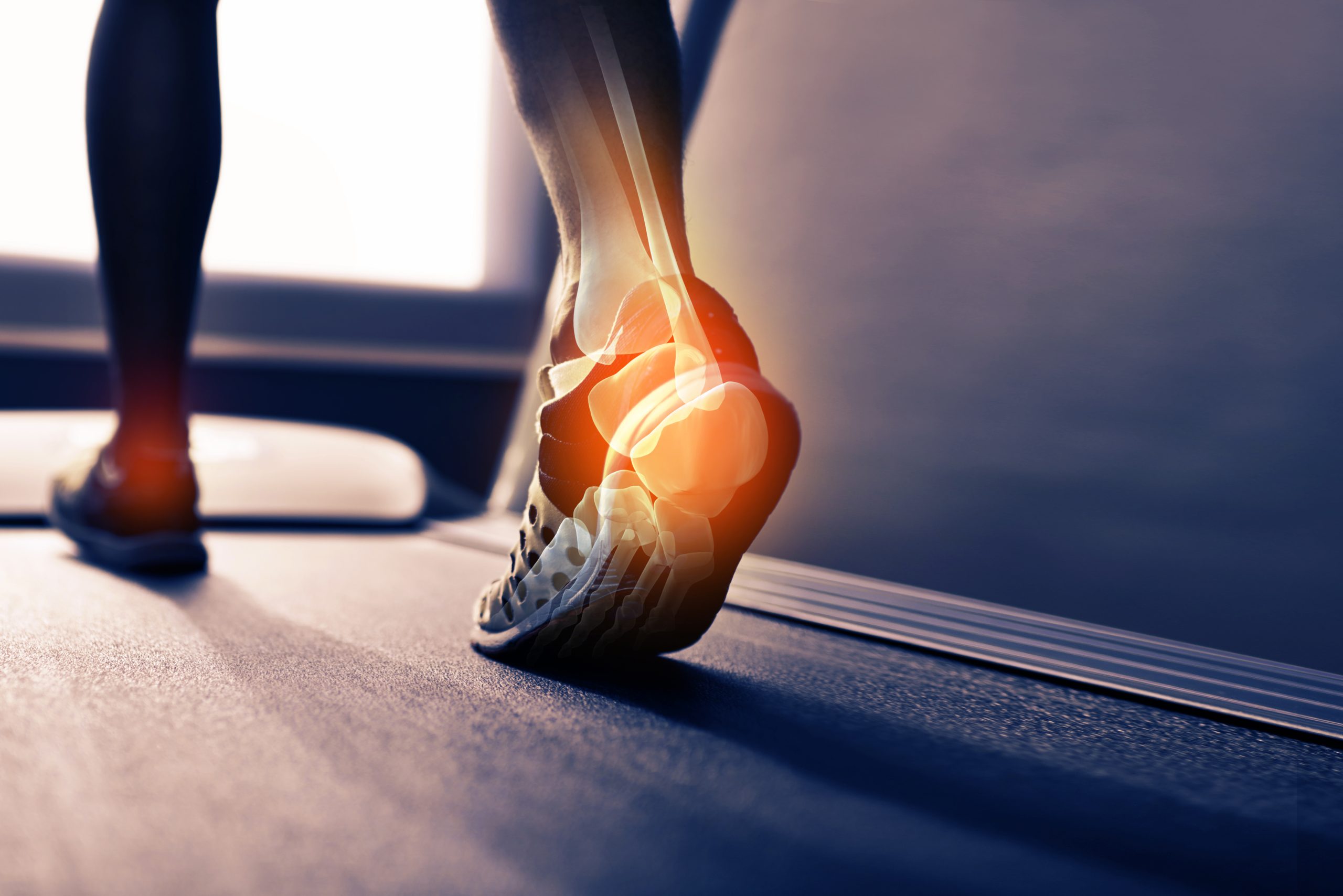 Close-up of a person’s foot in athletic shoes walking on a treadmill, with an illustration highlighting ankle pain—Movement As Medicine Classes support joint health and injury prevention.